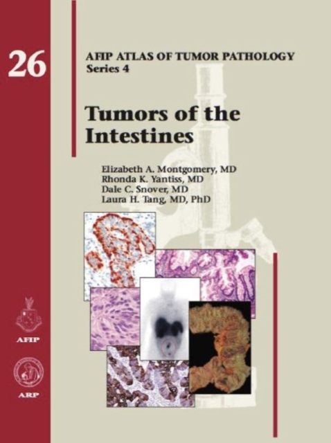 Tumors of the Intestines, Hardback Book