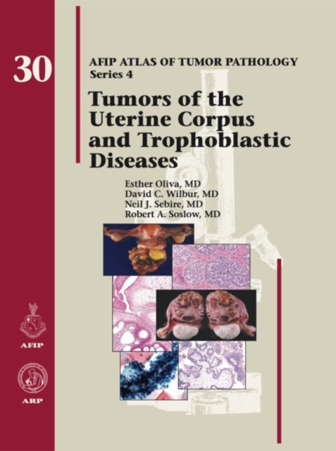 Tumors of the Uterine Corpus and Trophoblastic Diseases, Hardback Book