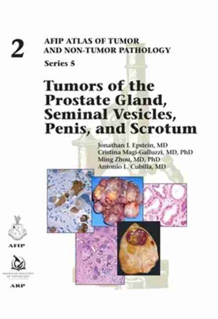 Tumors of the Prostate Gland, Seminal Vesicles, Penis, and Scrotum, Hardback Book