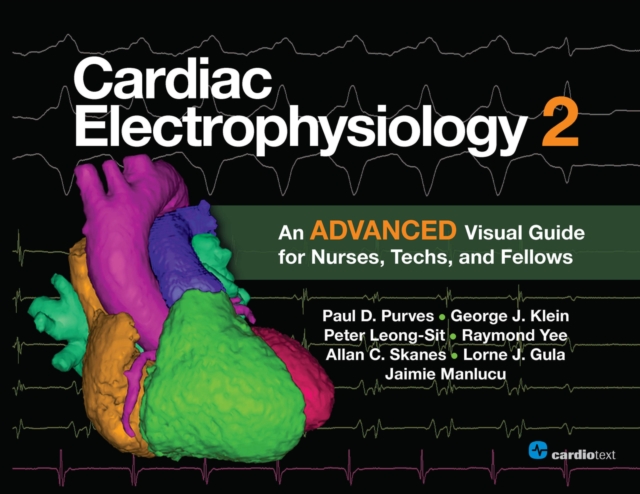 Cardiac Electrophysiology 2: An Advanced Visual Guide for Nurses, Techs, and Fellows : An Advanced Visual Guide for Nurses, Techs, and Fellows, PDF eBook