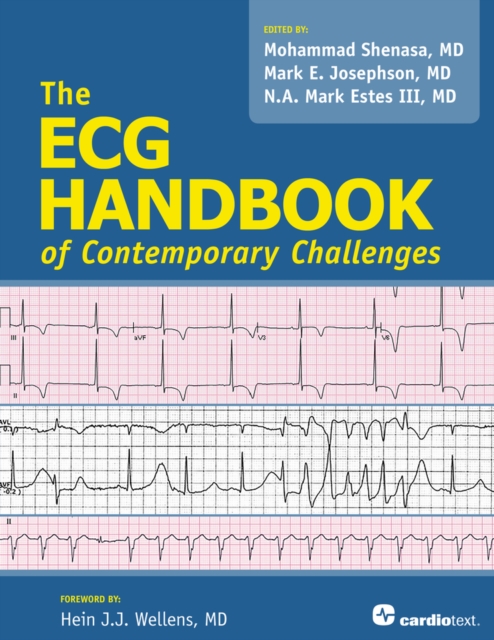 ECG Handbook of Contemporary Challenges, PDF eBook
