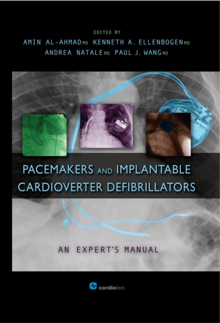 Pacemakers and Implantable Cardioverter Defibrillators: An Expert's Manual, PDF eBook