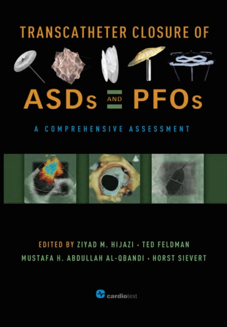 Transcatheter Closure of ASDs and PFOs : A Comprehensive Assessment, PDF eBook