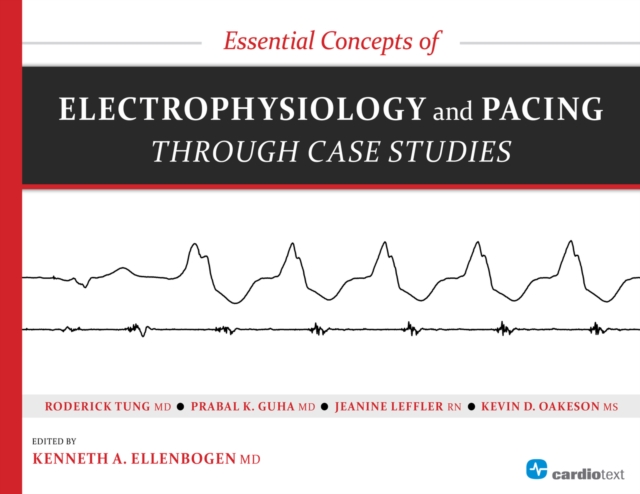 Essential Concepts of Electrophysiology and Pacing Through Case Studies, PDF eBook