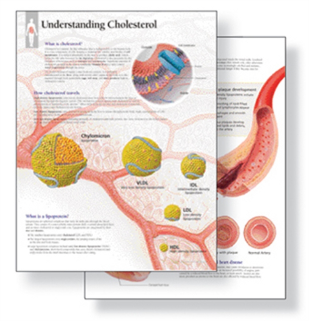 Understanding Cholesterol Study Set Replacement Pads : Patient Education Study Sets, Paperback / softback Book