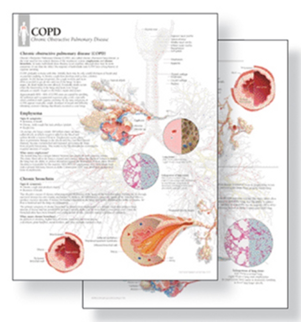 Understanding COPD Study Set Replacement Pads : Patient Education Study Sets, Paperback / softback Book