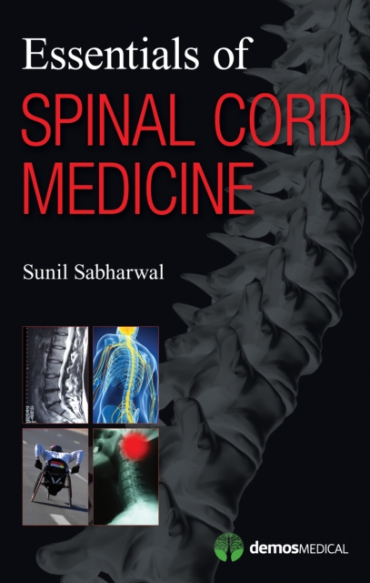 Essentials of Spinal Cord Medicine, Paperback / softback Book