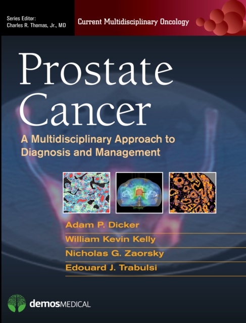 Prostate Cancer : A Multidisciplinary Approach to Diagnosis and Management, Hardback Book