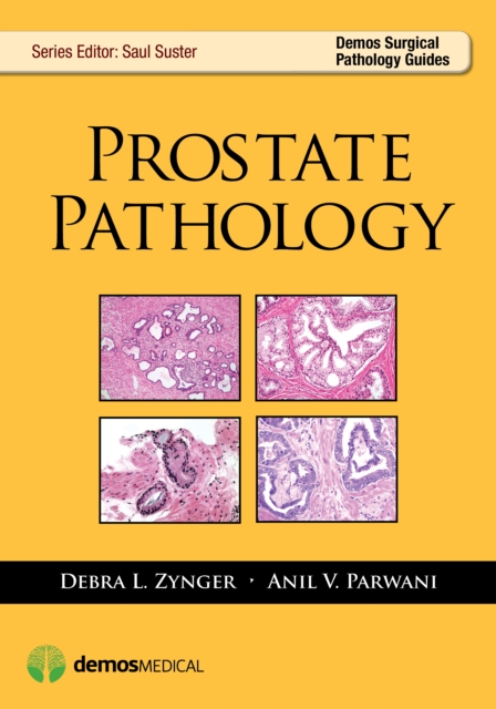 Prostate Pathology, Paperback / softback Book