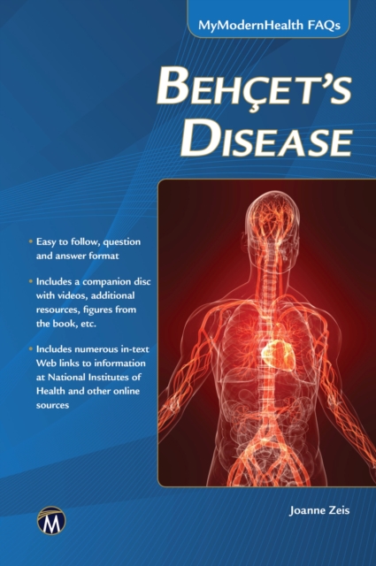 Behcet's Disease, EPUB eBook