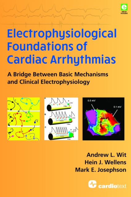 Electrophysiological Foundations of Cardiac Arrhythmias : A Bridge Between Basic Mechanisms and Clinical Electrophysiology, EPUB eBook