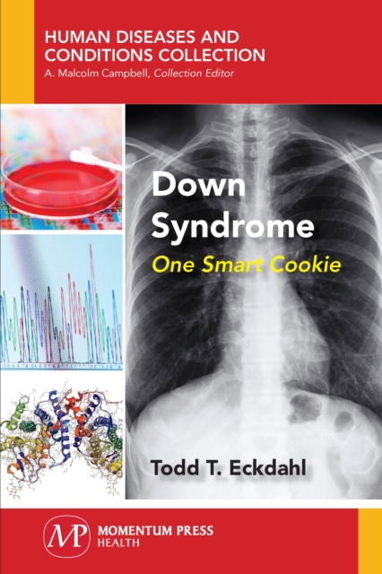 Down Syndrome : One Smart Cookie, Paperback / softback Book