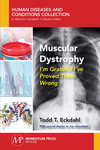 Muscular Dystrophy : I'm Grateful I've Proved Them Wrong, Paperback / softback Book