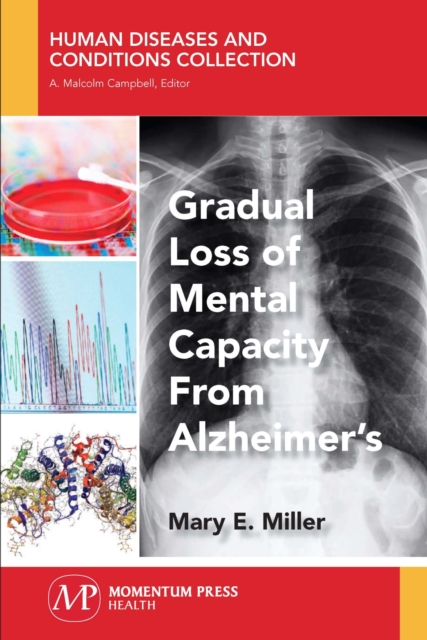 Gradual Loss of Mental Capacity from Alzheimer's, Paperback / softback Book