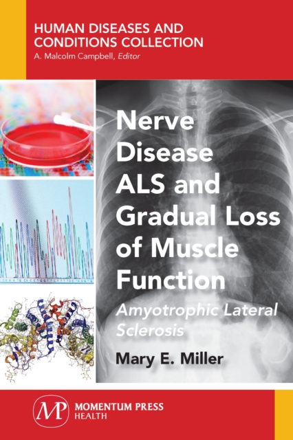 Nerve Disease ALS and Gradual Loss of Muscle Function : Amyotrophic Lateral Sclerosis, Paperback / softback Book
