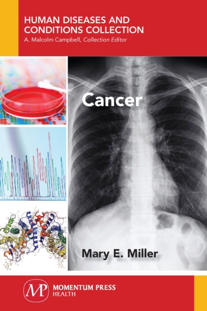 Cancer, Paperback / softback Book