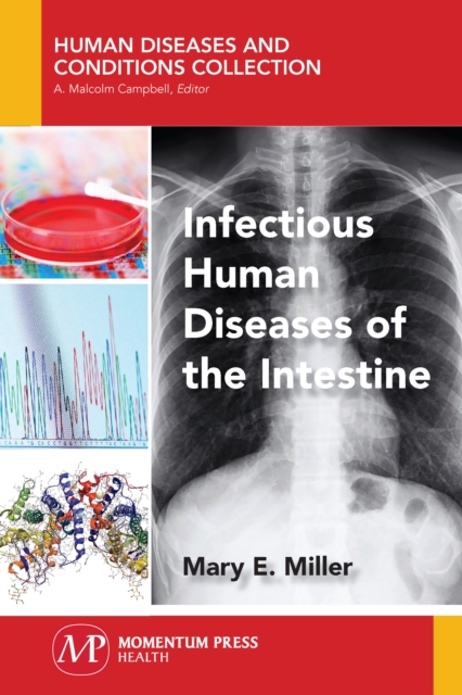 Infectious Human Diseases of the Intestine, EPUB eBook
