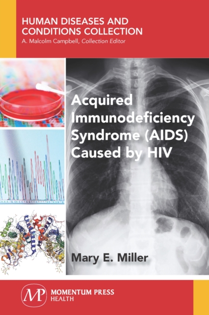 Acquired Immunodeficiency Syndrome (AIDS) Caused by HIV, Paperback / softback Book
