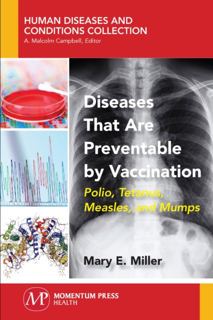 Diseases That Are Preventable by Vaccination : Polio, Tetanus, Measles, and Mumps, Paperback / softback Book