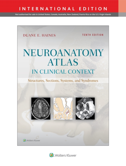 Neuroanatomy Atlas in Clinical Context : Structures, Sections, Systems, and Syndromes, Paperback / softback Book