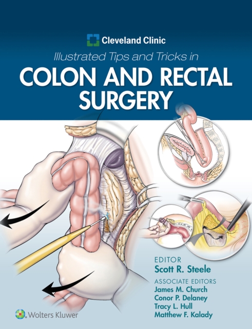 Cleveland Clinic Illustrated Tips and Tricks in Colon and Rectal Surgery, EPUB eBook