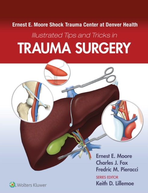 Ernest E. Moore Shock Trauma Center at Denver Health Illustrated Tips and Tricks in Trauma Surgery, EPUB eBook