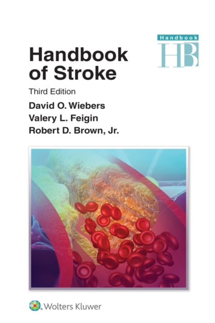 Handbook of Stroke, EPUB eBook