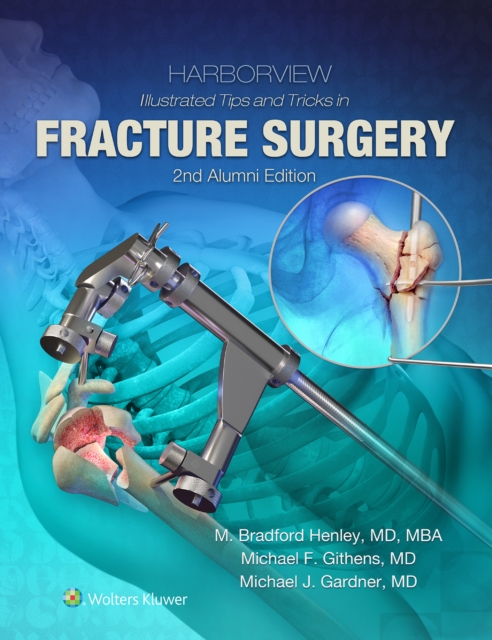 Harborview Illustrated Tips and Tricks in Fracture Surgery, EPUB eBook