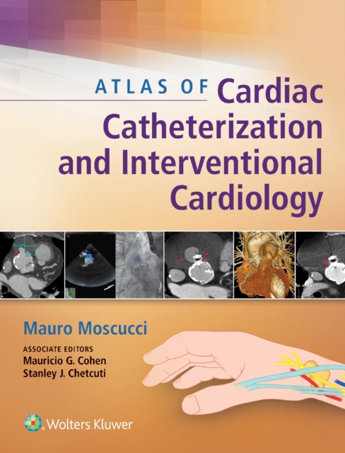 Atlas of Cardiac Catheterization and Interventional Cardiology, EPUB eBook