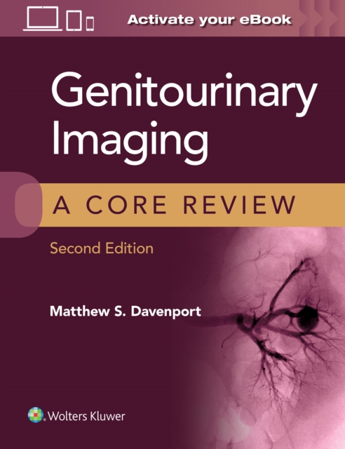 Genitourinary Imaging: A Core Review, Paperback / softback Book