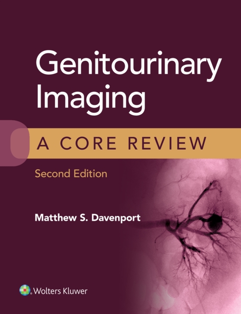 Genitourinary Imaging: A Core Review, EPUB eBook