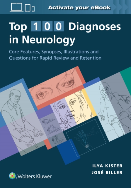 Top 100 Diagnoses in Neurology, Paperback / softback Book