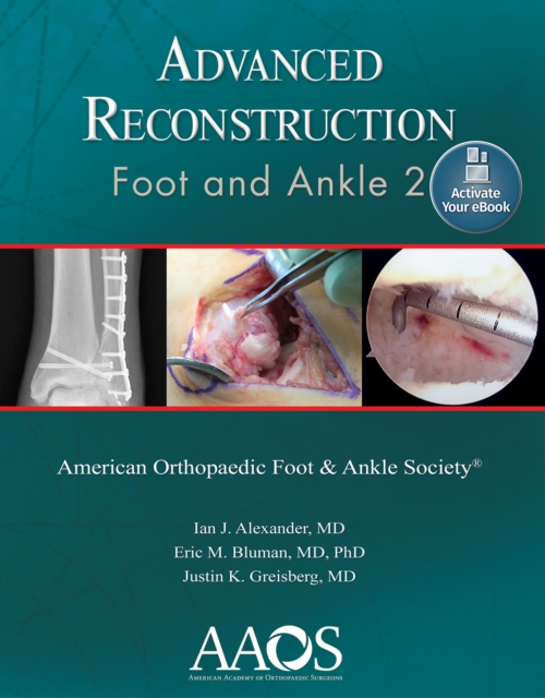 Advanced Reconstruction: Foot and Ankle 2: Print + Ebook, Paperback / softback Book