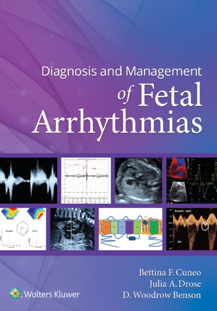 Diagnosis and Management of Fetal Arrhythmias, EPUB eBook