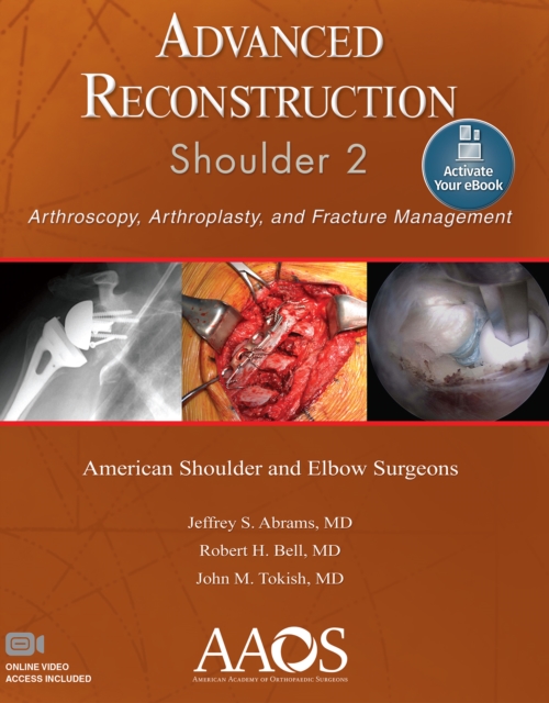 Advanced Reconstruction: Shoulder 2: Print + Ebook with Multimedia, Paperback / softback Book