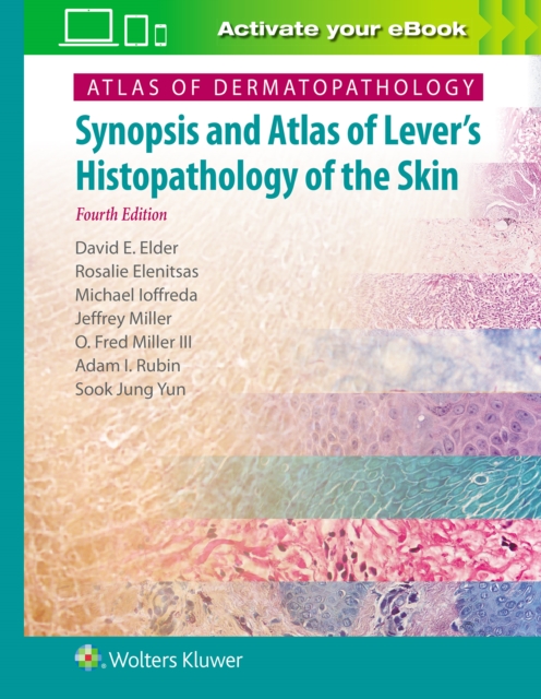 Atlas of Dermatopathology : Synopsis and Atlas of Lever’s Histopathology of the Skin, Hardback Book