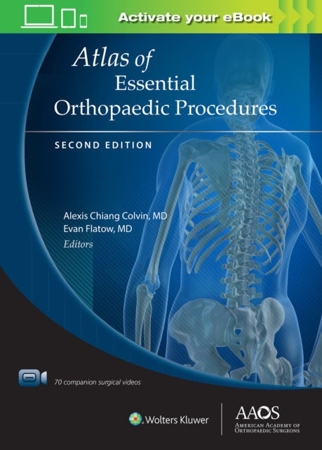 Atlas of Essential Orthopaedic Procedures, Second Edition: Print + Ebook with Multimedia, Hardback Book