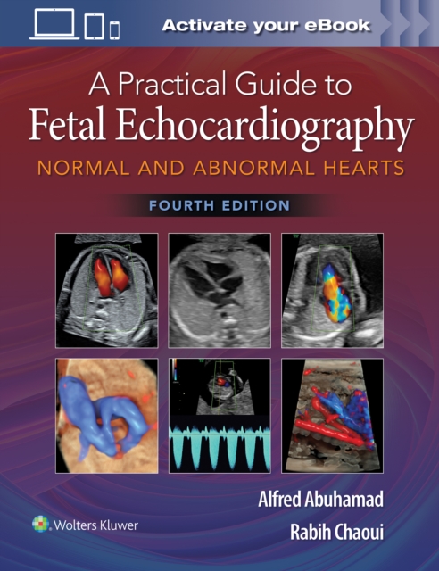 A Practical Guide to Fetal Echocardiography : Normal and Abnormal Hearts, Hardback Book