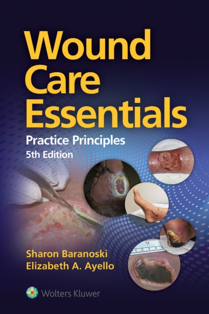 Wound Care Essentials, EPUB eBook