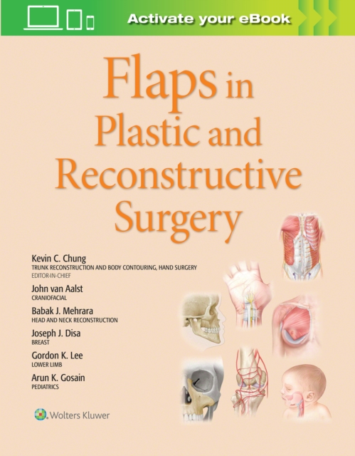 Flaps in Plastic and Reconstructive Surgery, Hardback Book