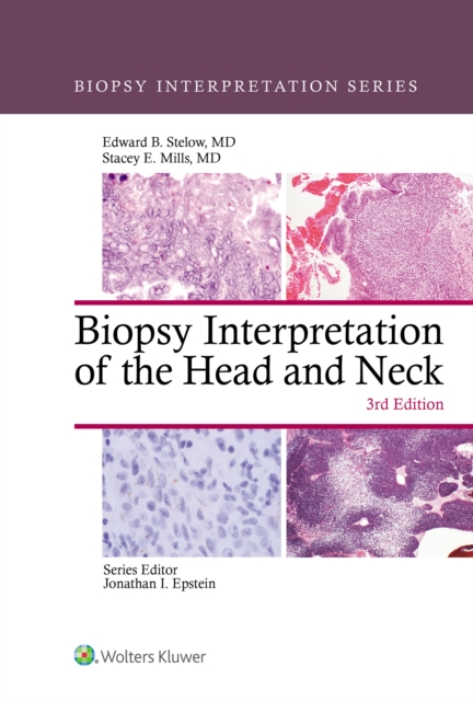 Biopsy Interpretation of the Head and Neck, EPUB eBook