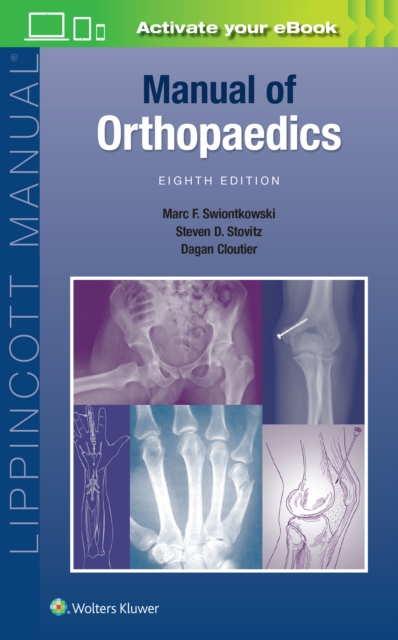 Manual of Orthopaedics, Paperback / softback Book
