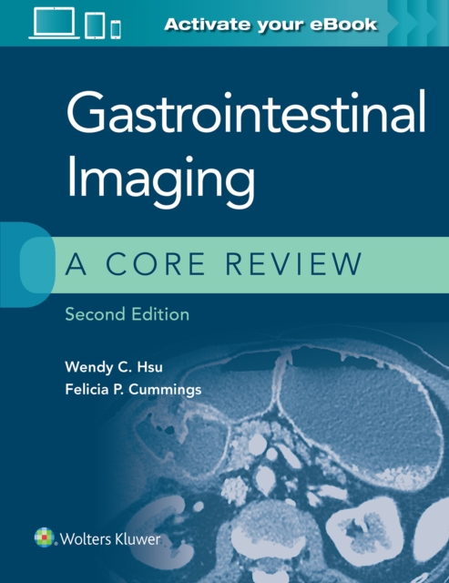 Gastrointestinal Imaging: A Core Review, Paperback / softback Book