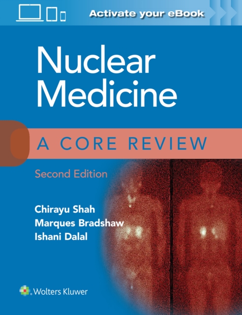 Nuclear Medicine: A Core Review, Paperback / softback Book
