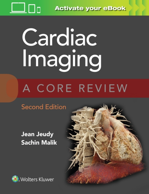 Cardiac Imaging: A Core Review, Paperback / softback Book