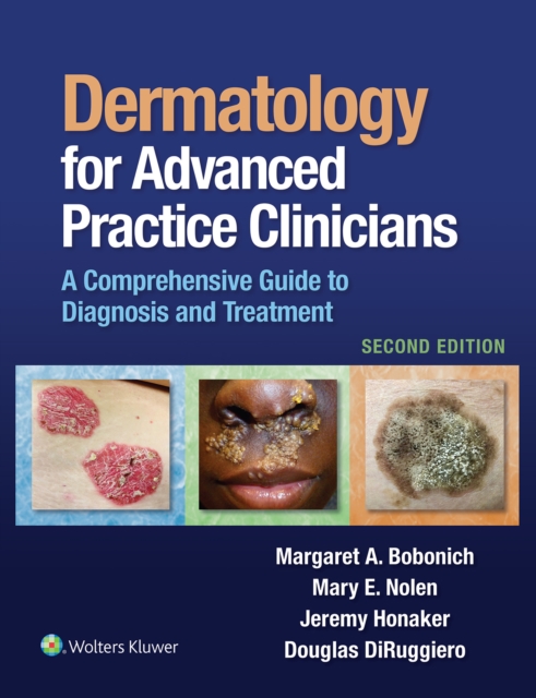 Dermatology for Advanced Practice Clinicians : A Practical Approach to Diagnosis and Management, EPUB eBook