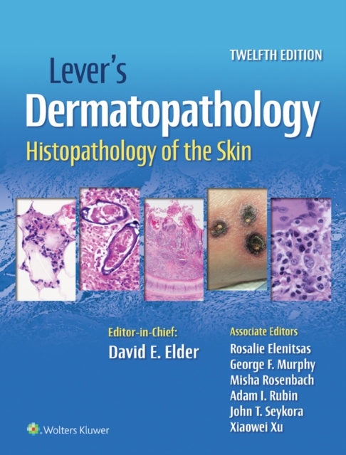Lever's Dermatopathology : Histopathology of the Skin, EPUB eBook