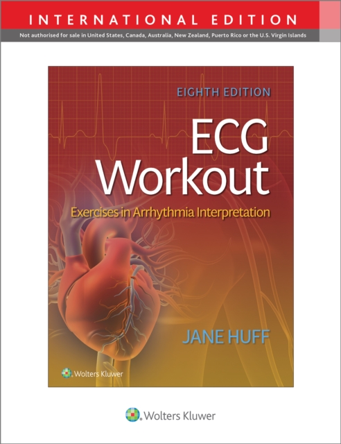 ECG Workout : Exercises in Arrythmia Interpretation, Paperback / softback Book