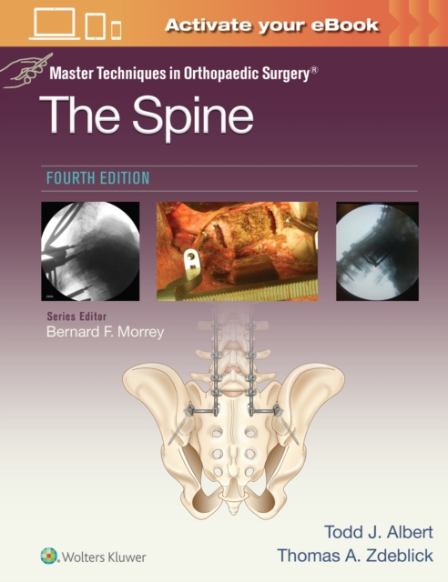 Master Techniques in Orthopaedic Surgery: The Spine, Hardback Book