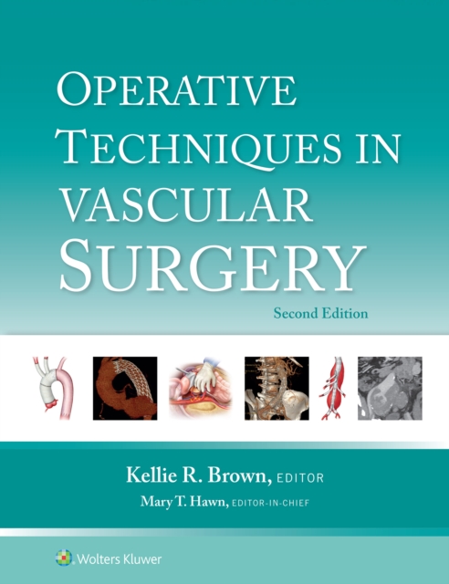 Operative Techniques in Vascular Surgery : eBook without Multimedia, EPUB eBook